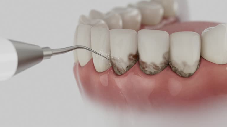 Trusted Wisdom Tooth Removal service in Pembroke, VA - Dentist Open Now